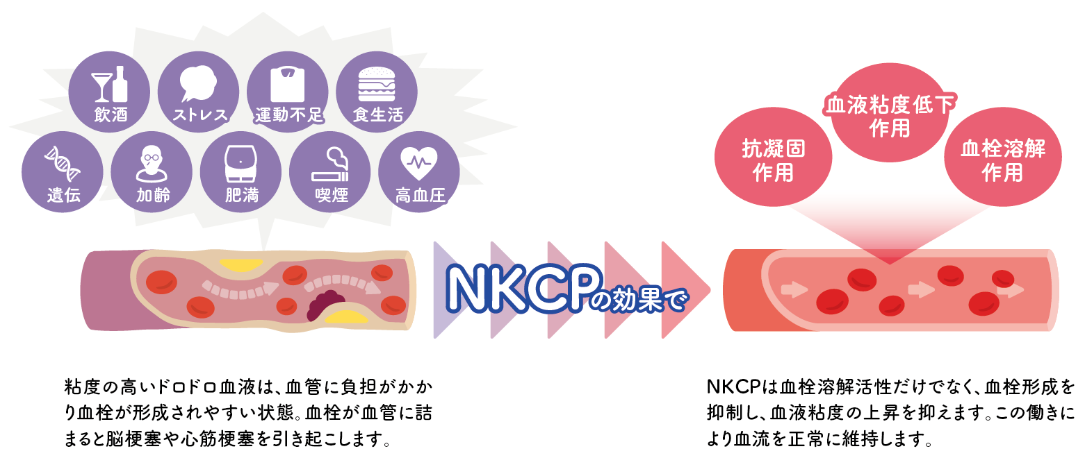 NKCPѪܤˌ넿